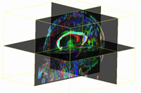 Systems and Cognitive Neuroscience