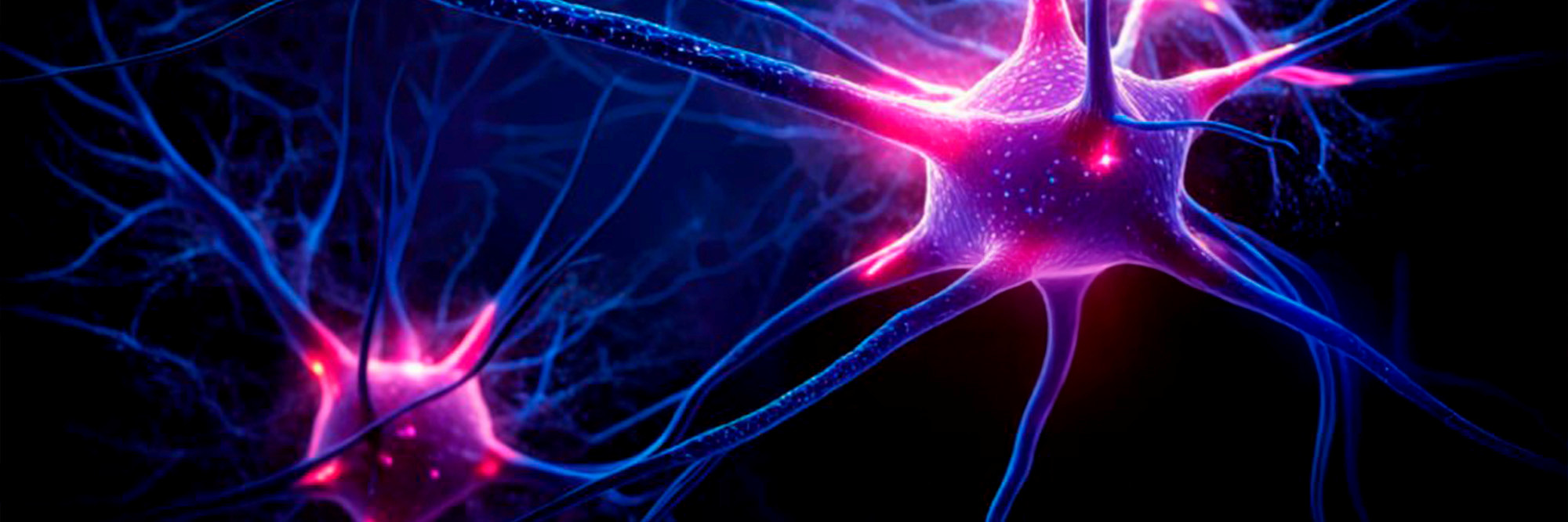 epilepsy image