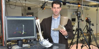 Upstate study to help determine treatment for common foot disorder