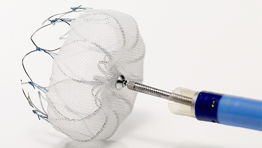 Upstate now offers Watchman implant to reduce stroke in patients with atrial fibrillation