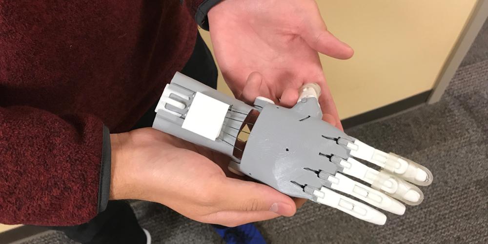 Medical students create prosthetic hand with 3-D printer