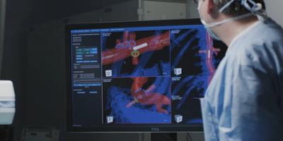 Upstate introduces new surgical navigation system for complex endovascular cases