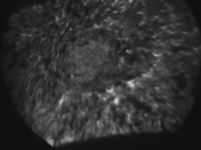 40Ca SIMS image