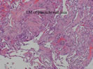 LM of parenchymal area