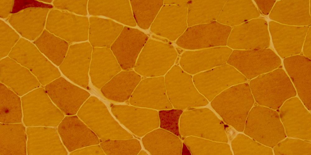 muscle tissue under microscope