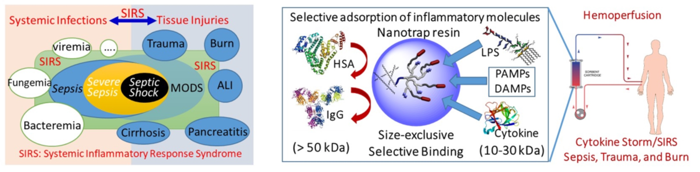 . Illustration of sepsis induced by both infections and traumatic tissue injury through a common pathophysiological process, e.g. systemic inflammatory response syndrome (SIRS). 