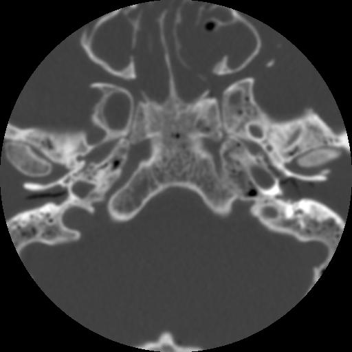 Image Reconstruction Radiology Suny Upstate Medical University