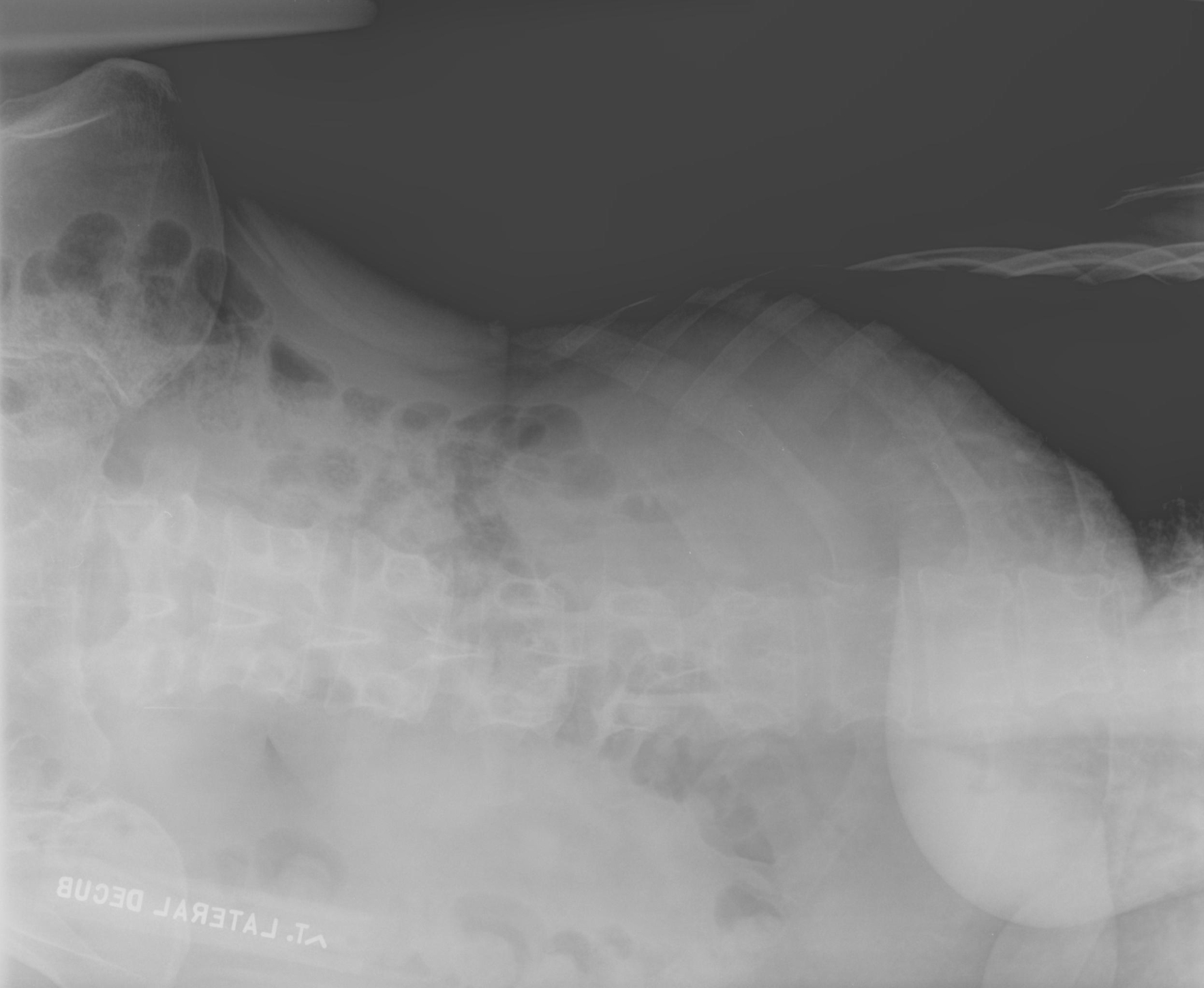 Regnfuld uld Korn Exposure Issues | Radiology | SUNY Upstate Medical University