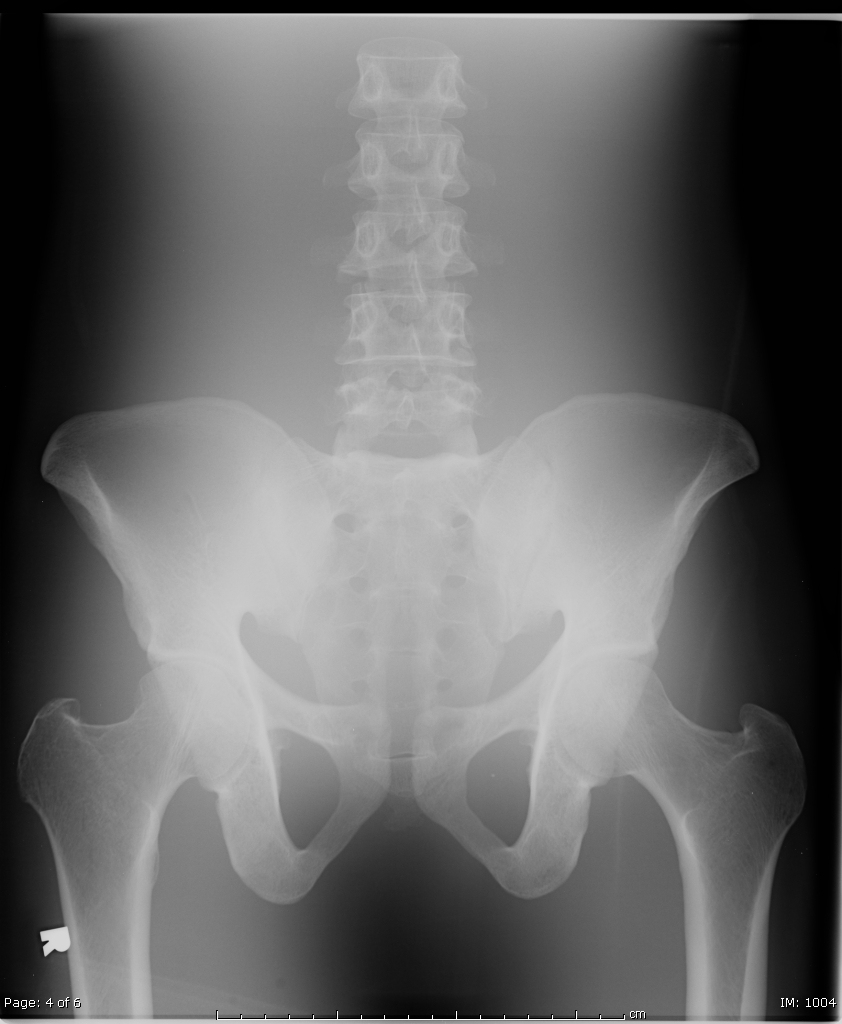 Blank X Ray Technique Chart