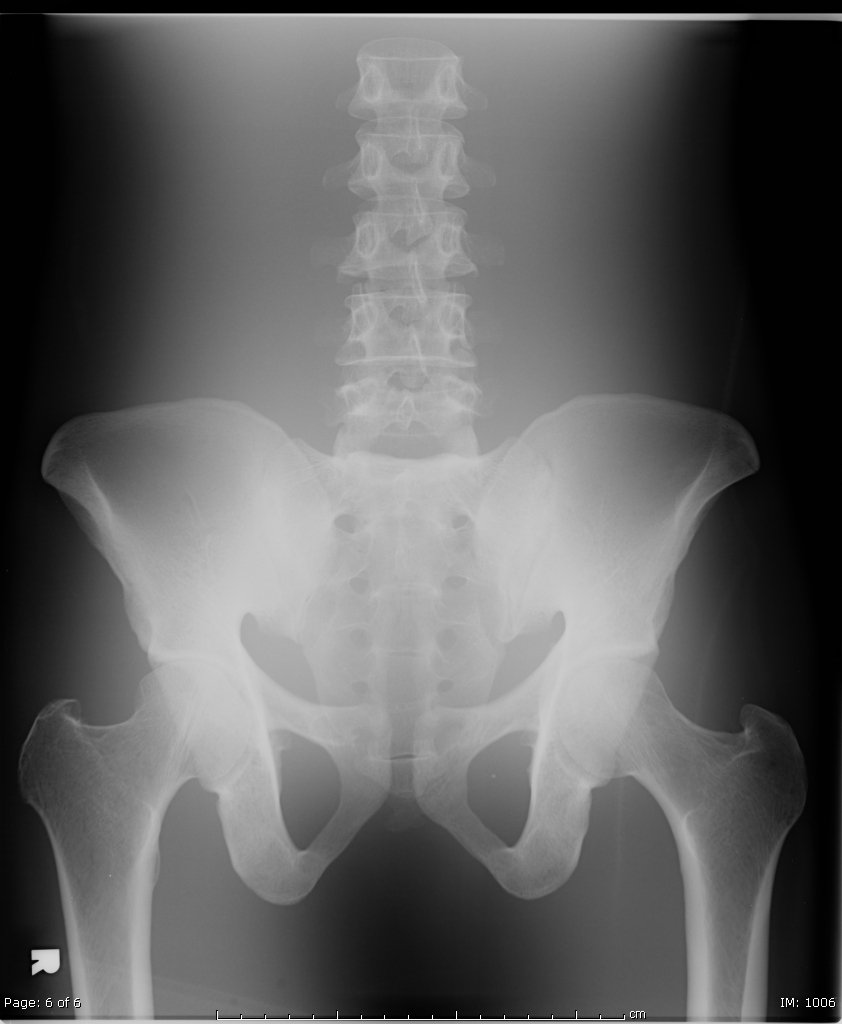 Blank X Ray Technique Chart