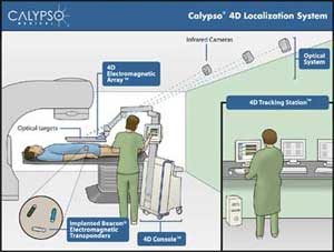 Calypso 4D Localization SystemóGPS for the Body