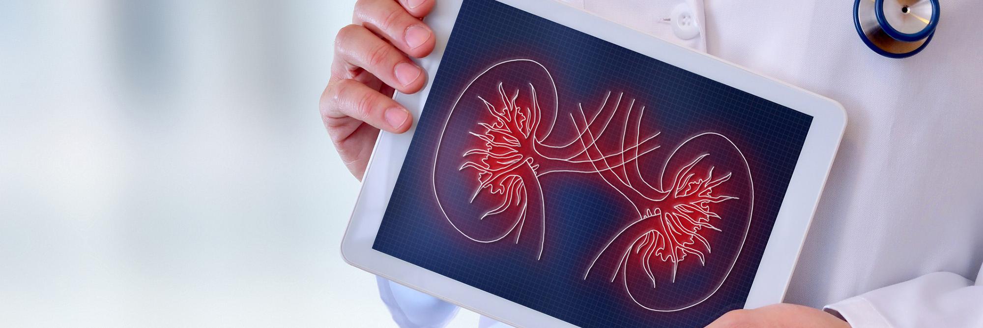 Upstate Transplant Program