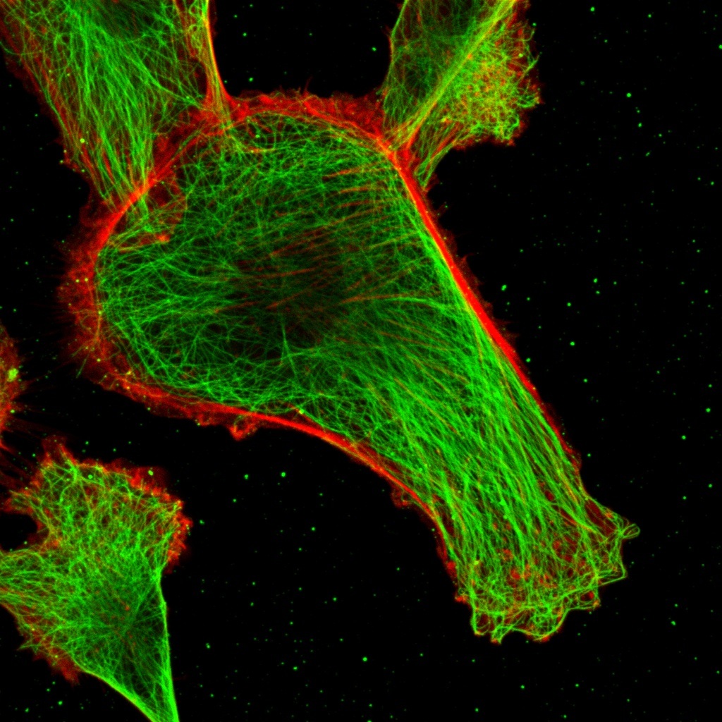 ImageJ=1.37v breast cancer cell photographed by Nick Deakin, PhD