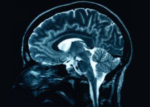 MP900385807 Brain scan