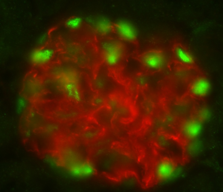 ImageJ=1.43u mouse kidney from the lab of Mira Krendel, PhD
