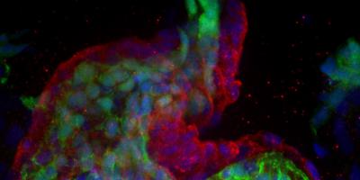 Heart in zebrafish embryo yields clues to human heart development