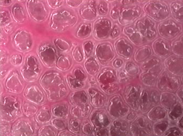 Normal rat alveoli. From the laboratory of senior research Gary Nieman.