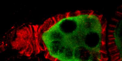 Upstate researcher focuses on what a protein can teach about cancer
