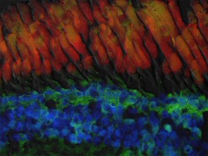 frog retinal cells