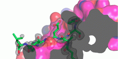 Upstate researchers decipher breast cancer clues in proteins