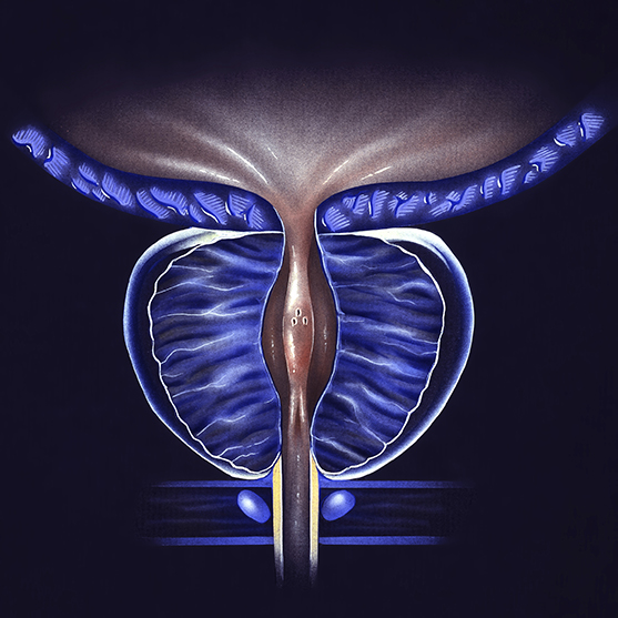 The prostate is a walnut-sized gland located between the bladder and the penis and just in front of the rectum. The urethra runs through the center of the prostate, from the bladder to the penis, letting urine flow out of the body.