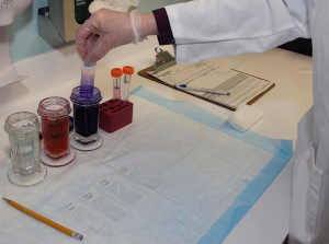 A biopsy done through fine needle aspiration is reviewed while the patient waits. (PHOTO BY WILLIAM MUELLER)