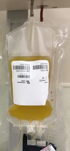 A bag of freshly donated platelets.