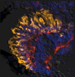 Multiple cell types necessary for vision (identified by the different colors) can be generated using only two genes in stem cells. (IMAGE COURTESY OF VICZIAN/ZUBER LAB)