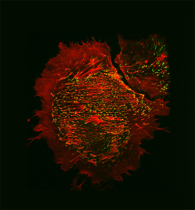 In this kidney cell image from Mira Krendel, PhD, an epithelial cell shows the protein scaffolding that is important for maintaining cell shape and supporting cell migration. The red staining highlights actin filaments that act as struts to support cell shape, while the adhesive plaques attaching the cell to the underlying surface are shown in green.