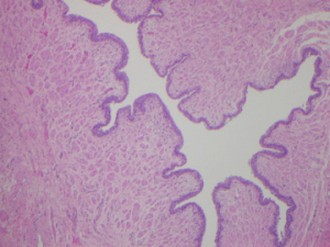 A normal cross-section of a urethra. (FROM THE LAB OF DMITRIY NIKOLAVSKY, MD)