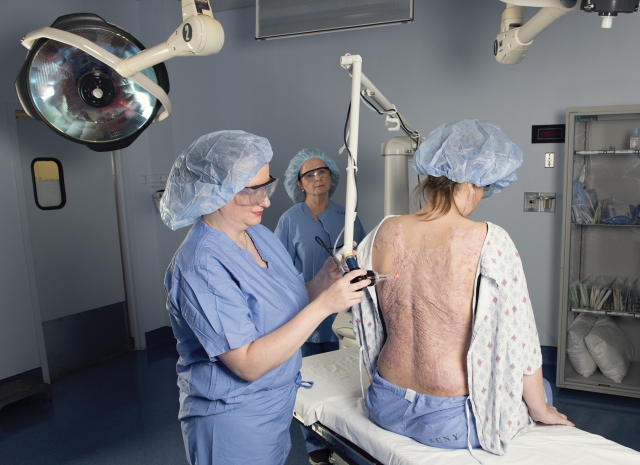 Burn surgeon Joan Dolinak, MD, uses a laser to restore skin on the back and arms of Stephanie Bridge, who survived a fire that destroyed her home. (PHOTO BY SUSAN KAHN)