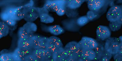 Complete and complex: More cancer patients benefit from molecular diagnostics
