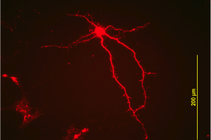 Above and below, nerve cells (from the lab of Wei-dong Yao, PhD)