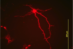 Above and below, nerve cells (from the lab of Wei-dong Yao, PhD)