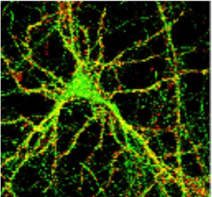 Nerve cells (from the lab of Wei-dong Yao, PhD)