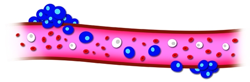 Some scientists have said the search for CTCs is like looking for a needle in a haystack. One millimeter of blood contains a few million white blood cells, around a billion red blood cells, and – perhaps – one to 10 circulating tumor cells. (illustration by Dan Cameron)