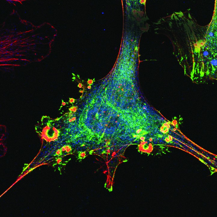 (Image courtesy of Anushree Gulvady and the lab of Christopher Turner, PhD)