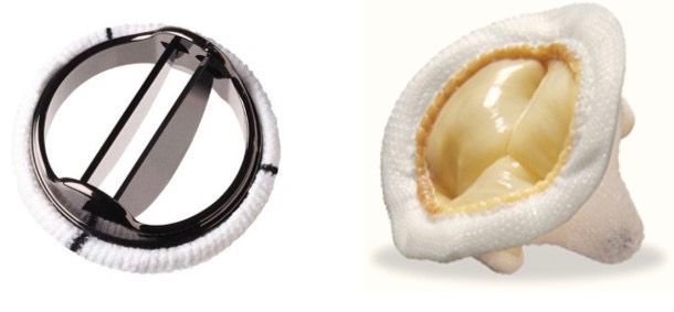 replacement mitral valves