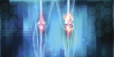 A nonsurgical way to treat knee osteoarthritis