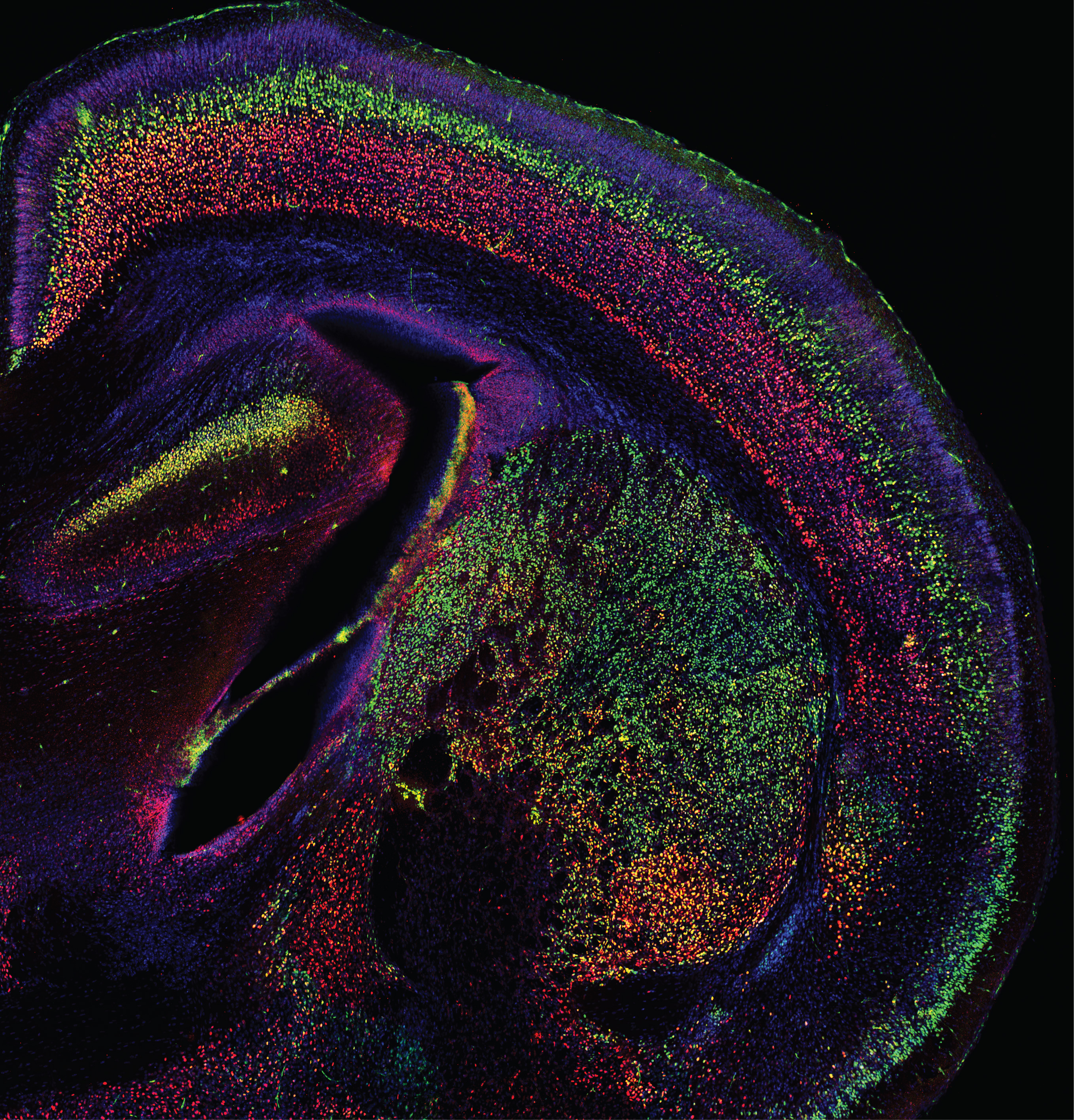 cerebral cortex cells