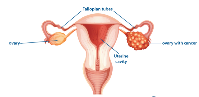 ovary diagram