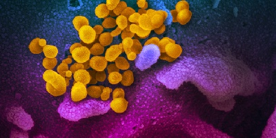 Science Is Art: Coronavirus up close
