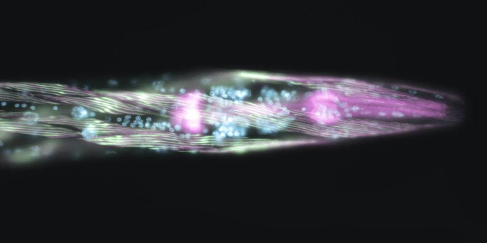 This image, “The Assembly of a Worm Rocket!,” won top honors for Sumana Sundaramurthy in a cell biology society’s contest.