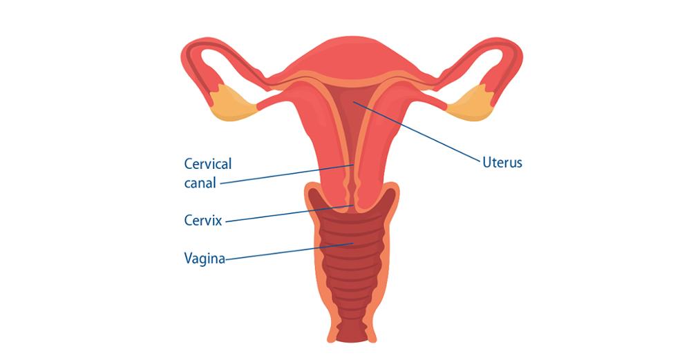 The cervix is the lower, narrow end of the uterus that forms a canal between the uterus and vagina.