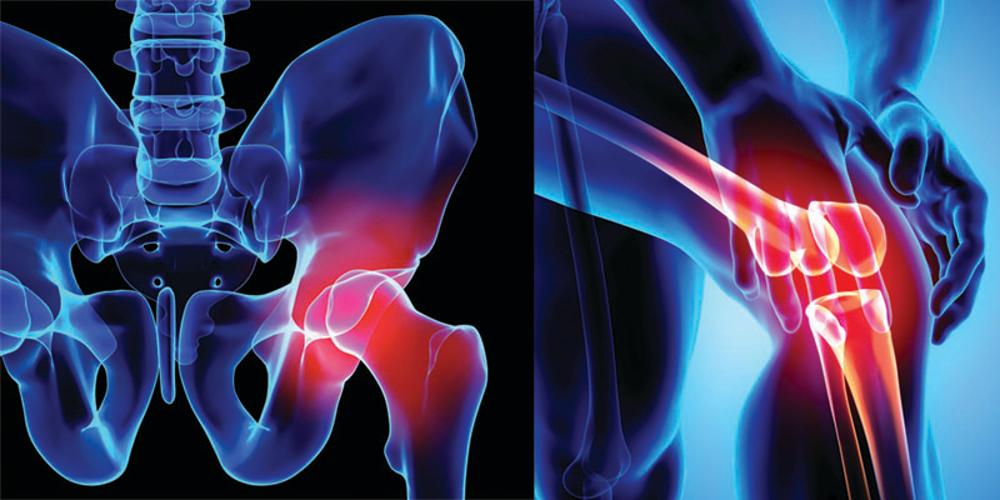 Swift Knee and Swift Hip replacement operations offer patients a quick discharge after surgery.
