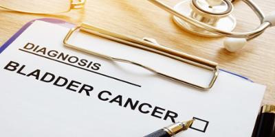 Advanced cancer that calls for aggressive treatment