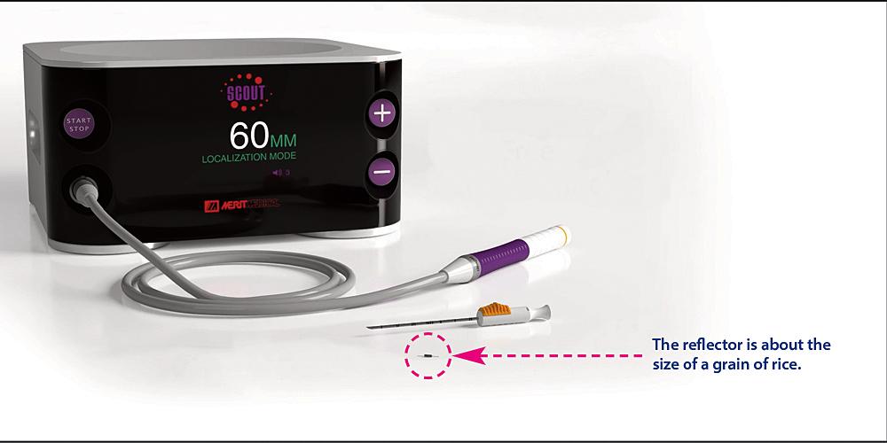 Using Savi Scout, a tiny sensor called a reflector is inserted into a tumor or abnormality in the breast. Radar waves signal its location.