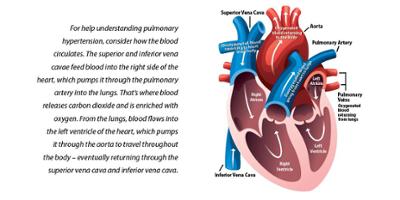 What is pulmonary hypertension?