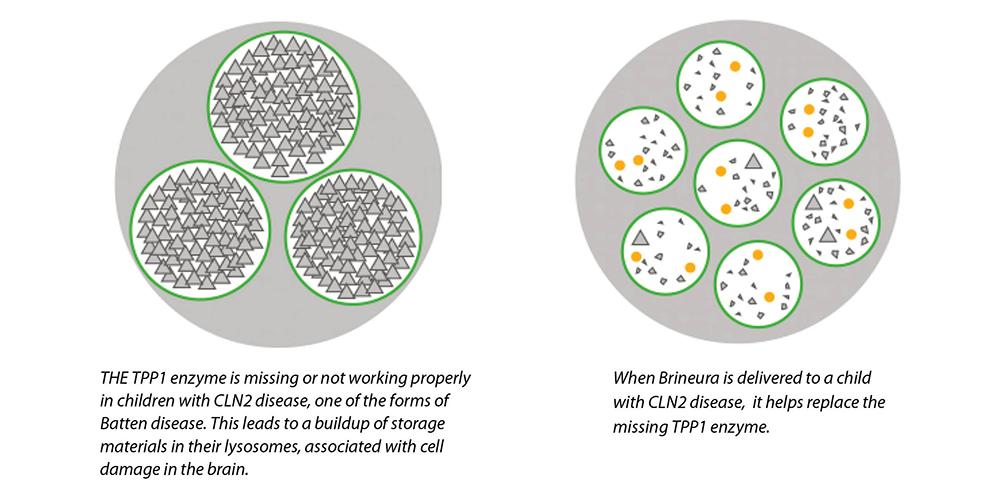 An enzyme is missing or not working properly in children with CLN2 disease, one of the forms of Batten disease.