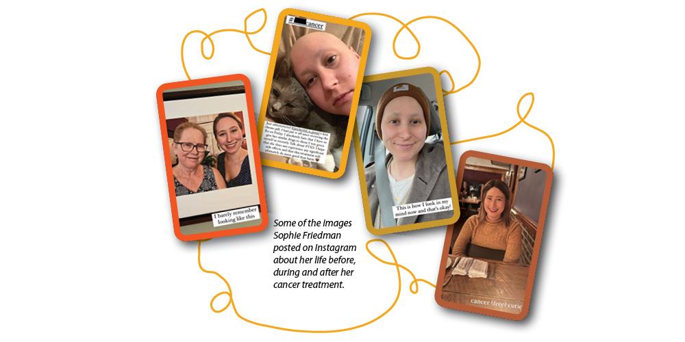 Some of the images Sophie Friedman posted about her life before, during and after cancer treatment.